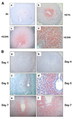 Connexin 43 Antibody in Immunohistochemistry (IHC)