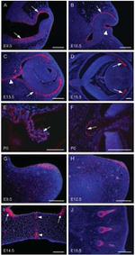 Connexin 43 Antibody in Immunohistochemistry (IHC)