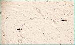 Connexin 43 Antibody in Immunohistochemistry (IHC)
