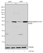 Phospho-SMAD3 (Ser423, Ser425) Antibody in Western Blot (WB)
