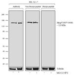 Phospho-JAK2 (Tyr1007, Tyr1008) Antibody in Western Blot (WB)
