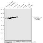 alpha Actinin 2 Antibody in Western Blot (WB)