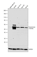 Glutaminase Antibody in Western Blot (WB)