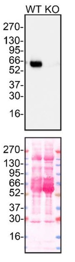 alpha-1 Antitrypsin Antibody