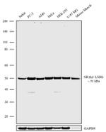 LXR beta Recombinant Superclonal™ Antibody (8 HCLC)