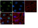RAD1 Recombinant Superclonal™ Antibody (8HCLC)