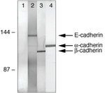 alpha Catenin Antibody in Immunoprecipitation (IP)