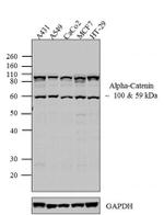 alpha Catenin Polyclonal Antibody
