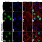 Phospho-ATF2 (Tyr69, Thr71) Recombinant Superclonal™ Antibody (24HCLC)