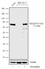 Phospho-Syk (Tyr323, Tyr317) Antibody in Western Blot (WB)