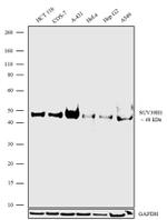 SUV39H1 Antibody in Western Blot (WB)