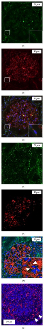 Occludin Antibody in Immunocytochemistry (ICC/IF)