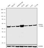 FOXN3 Antibody in Western Blot (WB)