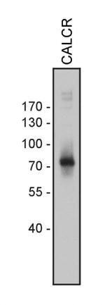 Calcitonin Receptor Antibody in Western Blot (WB)