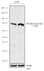 Phospho-PKC beta-1 (Thr642) Recombinant Superclonal™ Antibody (23HCLC)