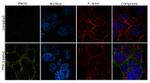 NSE Recombinant Superclonal™ Antibody (10HCLC)