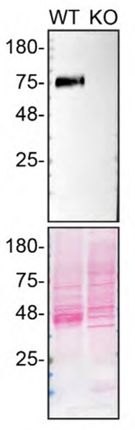 LIMP2 Antibody in Western Blot (WB)