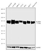 LIMP2 Recombinant Superclonal™ Antibody (12HCLC)
