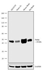 Parkin Recombinant Superclonal™ Antibody (21HCLC)