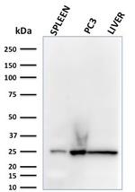 C1QA/Complement C1q A-Chain Monoclonal Antibody (C1QA, 2783)