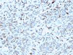 C1QA/Complement C1q A-Chain Monoclonal Antibody (C1QA/2952)