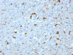 C1QA/Complement C1q A-Chain Monoclonal Antibody (C1QA/2953)