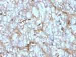 C1QA/Complement C1q A-Chain Monoclonal Antibody (C1QA/2954)