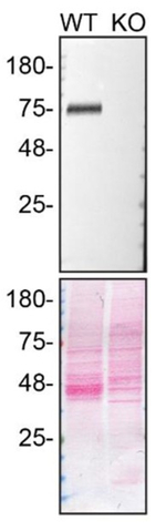 LIMP2 Antibody