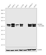 IGF2BP2 Antibody in Western Blot (WB)