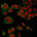 TNF-alpha (Tumor Necrosis Factor alpha) Monoclonal Antibody (4C6-H8)