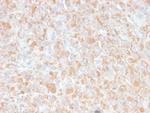 TNF-alpha (Tumor Necrosis Factor alpha) Antibody in Immunohistochemistry (Paraffin) (IHC (P))