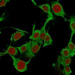 TNF-alpha (Tumor Necrosis Factor alpha) Monoclonal Antibody (TNFA, 1172)