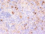 TNF-alpha (Tumor Necrosis Factor alpha) Monoclonal Antibody (TNF706, P/T2)
