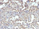 TNF-alpha (Tumor Necrosis Factor alpha) Recombinant Rabbit Monoclonal Antibody (TNF/1500R)
