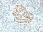 TNF-alpha (Tumor Necrosis Factor alpha) Antibody in Immunohistochemistry (Paraffin) (IHC (P))