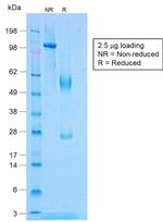 TNF-alpha (Tumor Necrosis Factor alpha) Antibody in SDS-PAGE (SDS-PAGE)