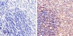 STAT5 beta Polyclonal Antibody