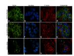 CK2 alpha-1 Antibody