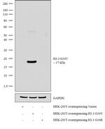H3.3 G34V oncohistone mutant Antibody in Western Blot (WB)