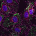 beta Catenin Antibody in Immunocytochemistry (ICC/IF)