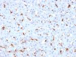 C1QB/Complement C1q B-Chain Monoclonal Antibody (C1QB/2961)