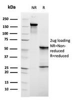 C1QB/Complement C1q B-Chain Antibody in SDS-PAGE (SDS-PAGE)