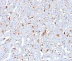 C1QB/Complement C1q B-Chain Monoclonal Antibody (C1QB/2962)