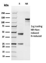 C1QB/Complement C1q B-Chain Antibody in SDS-PAGE (SDS-PAGE)