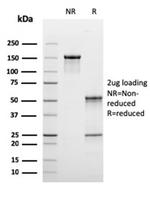 C1QB/Complement C1q B-Chain Antibody in SDS-PAGE (SDS-PAGE)