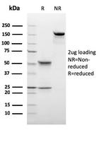 C1QB/Complement C1q B-Chain Antibody in SDS-PAGE (SDS-PAGE)