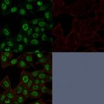 Topoisomerase II alpha (Proliferation and Drug-Resistance Marker) Monoclonal Antibody (TOP2A/1361)