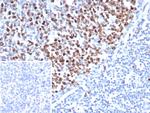 Topoisomerase II alpha (Proliferation and Drug-Resistance Marker) Antibody in Immunohistochemistry (Paraffin) (IHC (P))