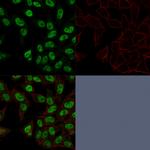 Topoisomerase II alpha Monoclonal Antibody (TOP2A, 1362)