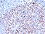 Topoisomerase II alpha (Proliferation and Drug-Resistance Marker) Antibody in Immunohistochemistry (Paraffin) (IHC (P))